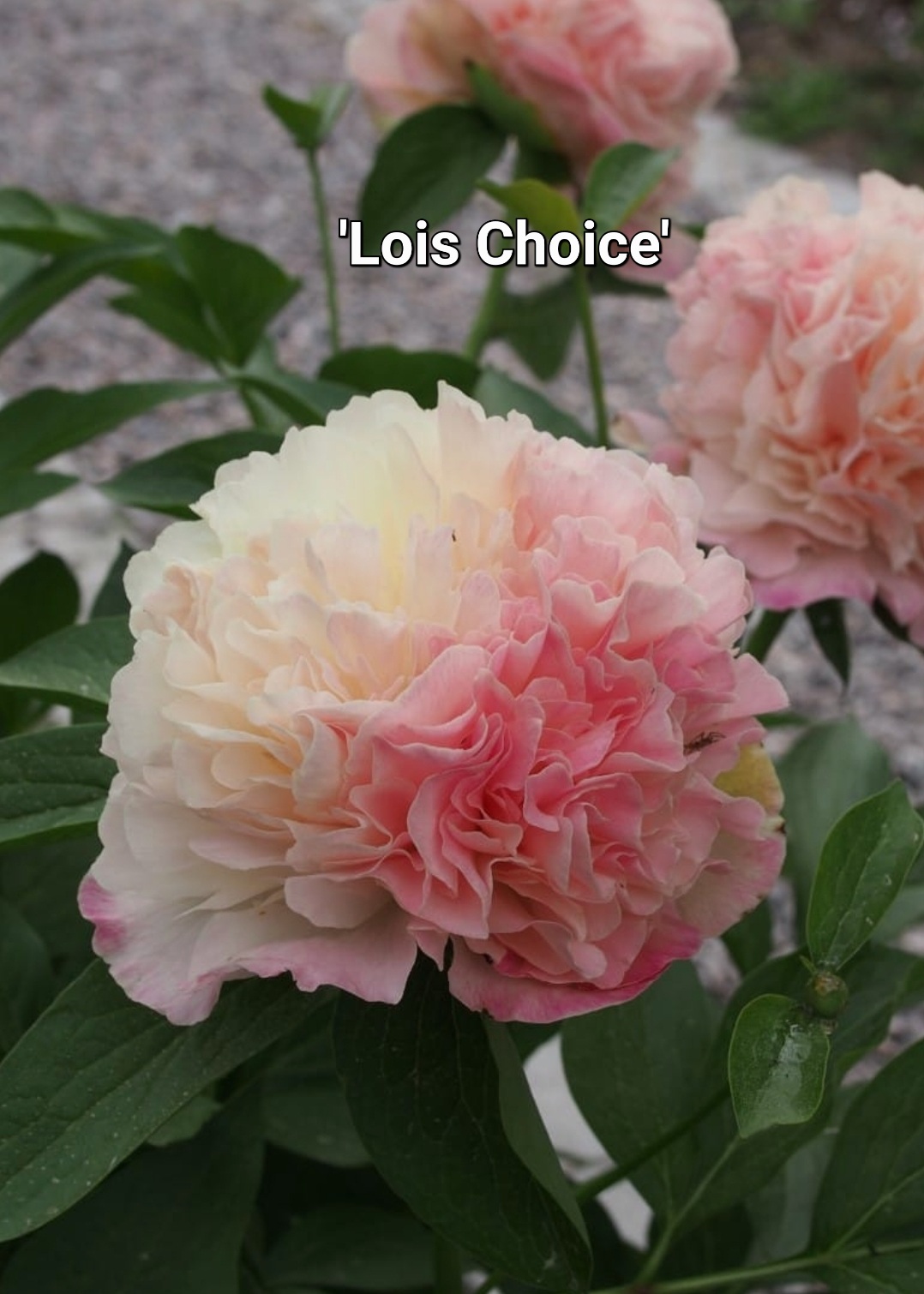 'Lois Choice'